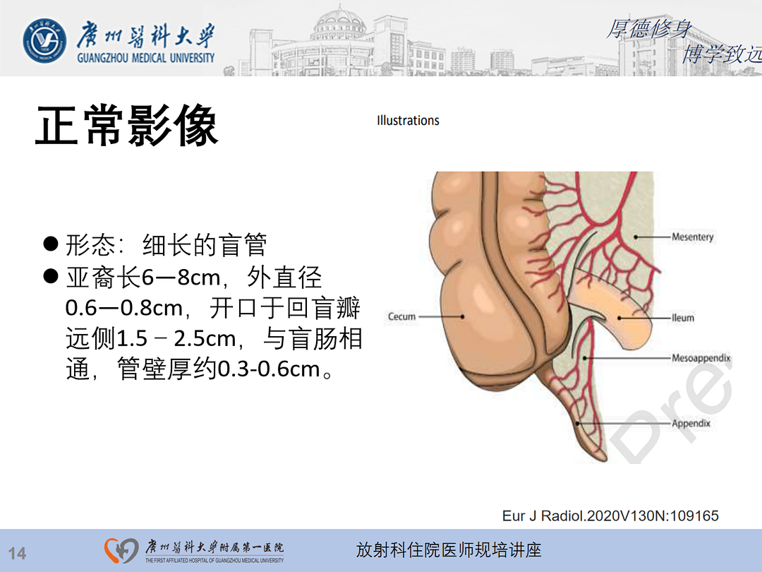影像PPT - 【PPT】急性阑尾炎影像诊断思考和综述-15