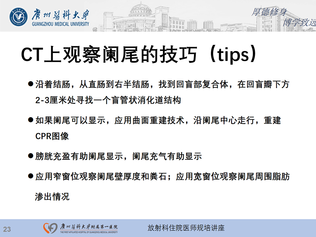 影像PPT - 【PPT】急性阑尾炎影像诊断思考和综述-24