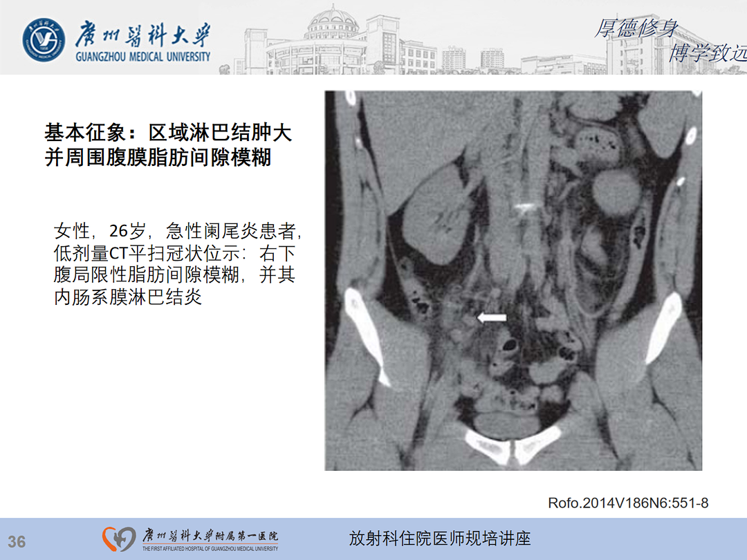 影像PPT - 【PPT】急性阑尾炎影像诊断思考和综述-37