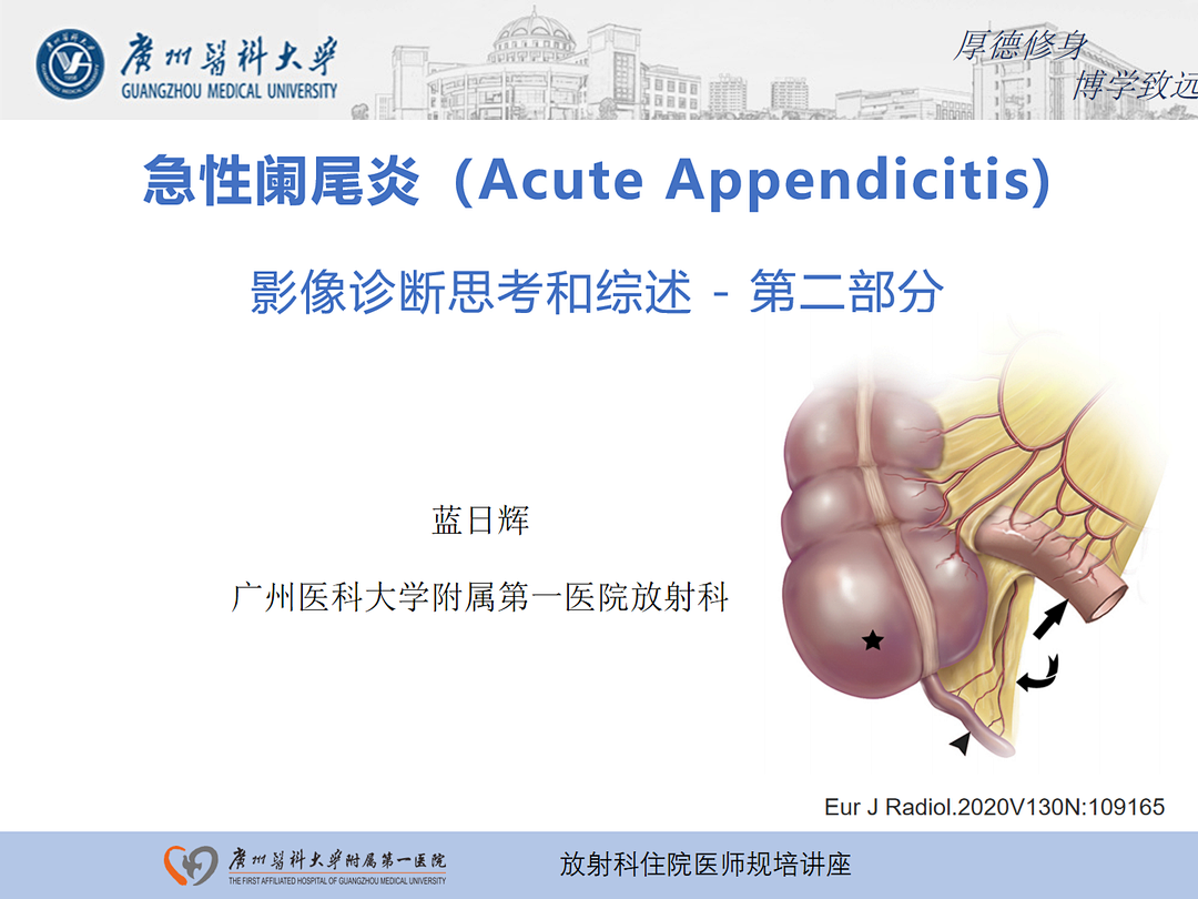 影像PPT - 【PPT】急性阑尾炎影像诊断思考和综述-64