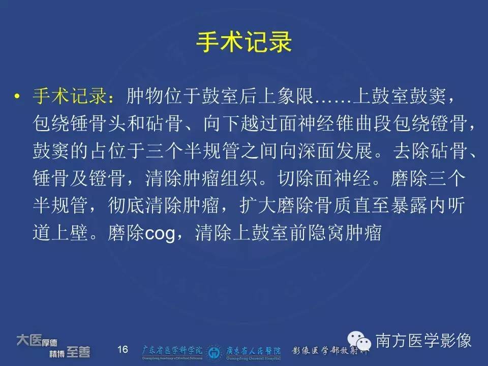 影像PPT - 【PPT】鼻咽癌累及中耳及与中耳炎的鉴别-16