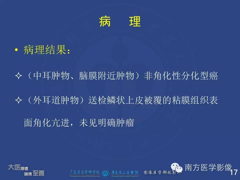 影像PPT - 【PPT】鼻咽癌累及中耳及与中耳炎的鉴别-17