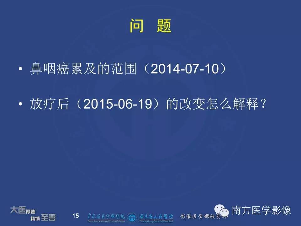 影像PPT - 【PPT】鼻咽癌累及中耳及与中耳炎的鉴别-15
