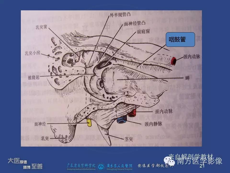 影像PPT - 【PPT】鼻咽癌累及中耳及与中耳炎的鉴别-21