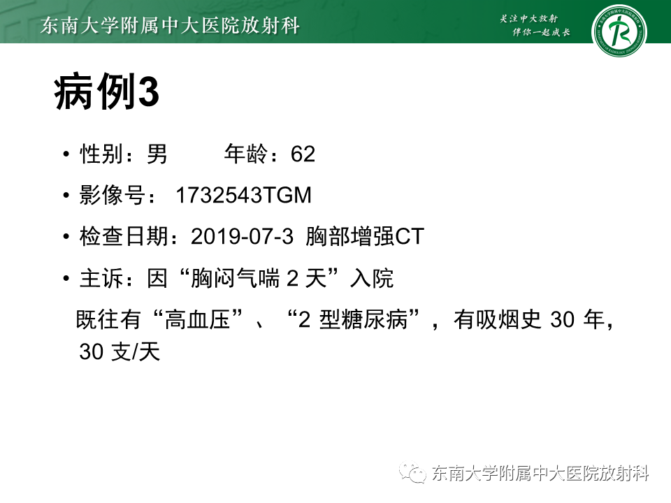 影像PPT - 【PPT】肺结节病-42