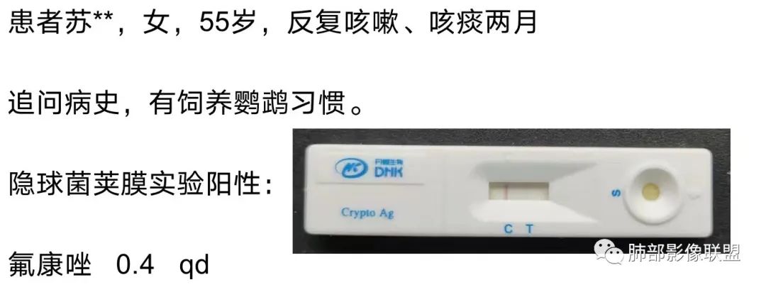 影像PPT - 【病例】经典的胸膜下病灶—隐球菌1例CT-19 影像PPT - 【病例】经典的胸膜下病灶—隐球菌1例CT-19