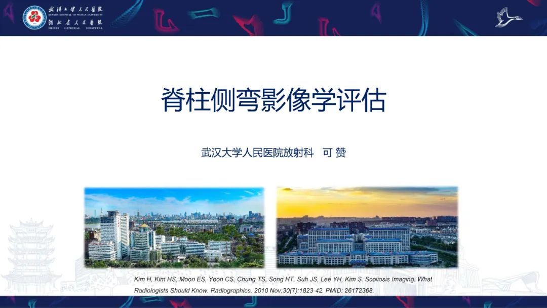 影像PPT - 【PPT】脊柱侧弯影像学评估-1