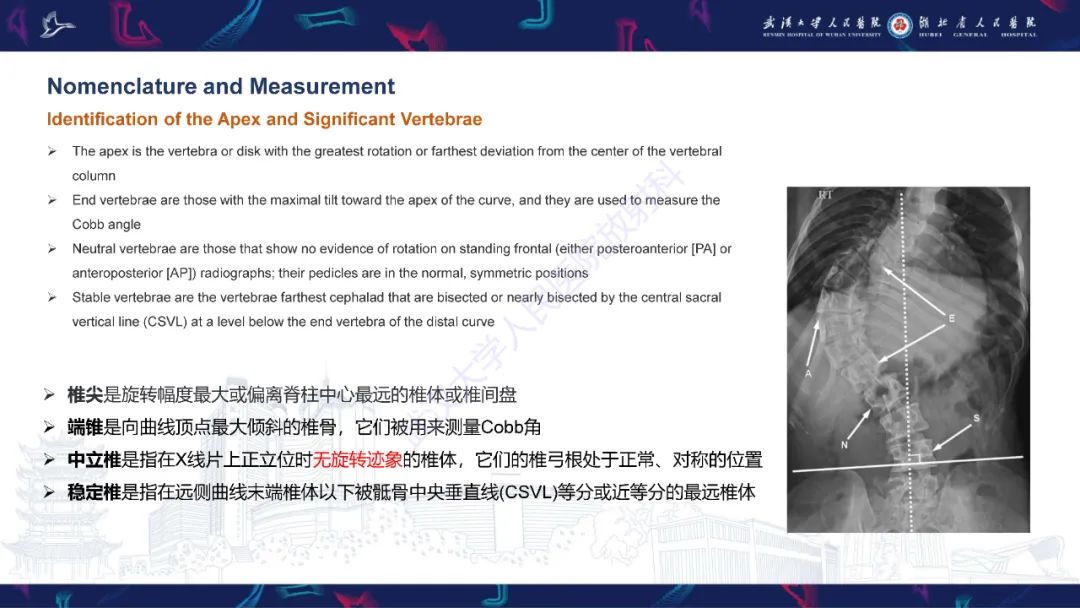 影像PPT - 【PPT】脊柱侧弯影像学评估-9