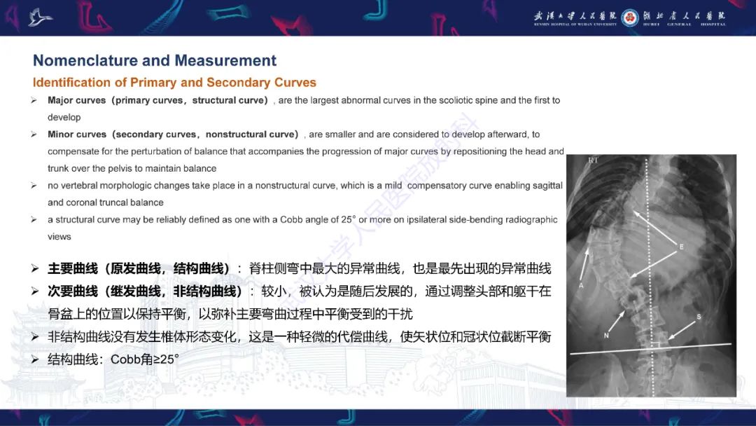 影像PPT - 【PPT】脊柱侧弯影像学评估-14