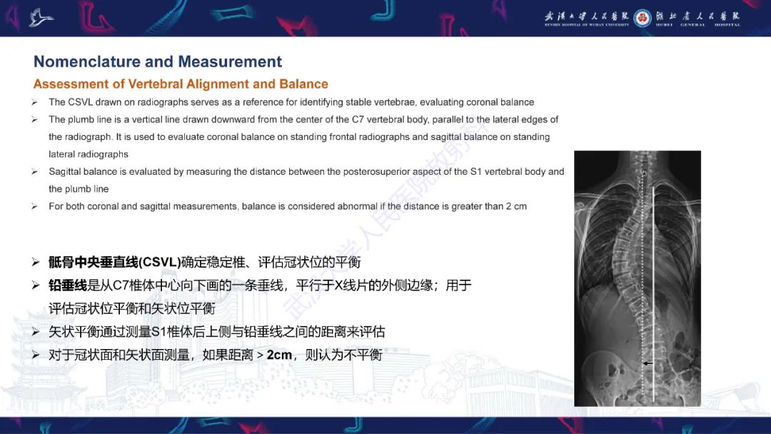 影像PPT - 【PPT】脊柱侧弯影像学评估-16