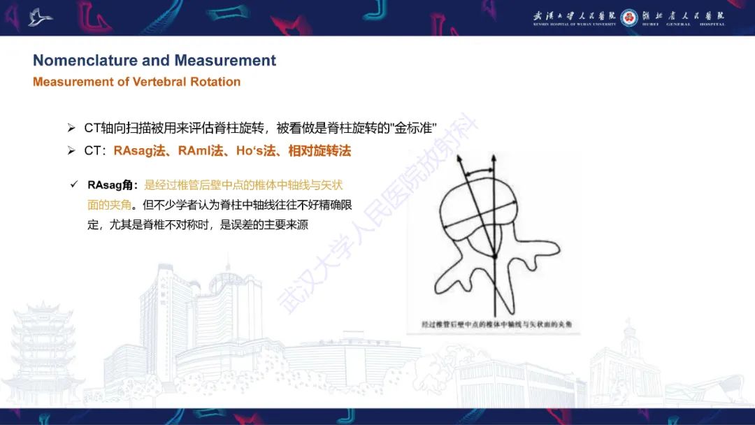 影像PPT - 【PPT】脊柱侧弯影像学评估-21