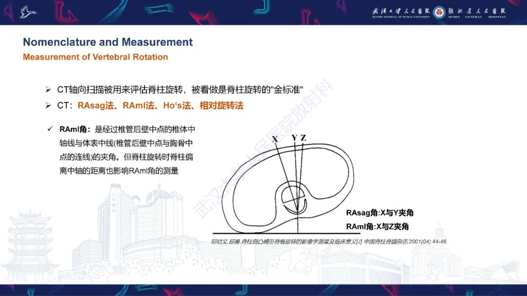 影像PPT - 【PPT】脊柱侧弯影像学评估-22