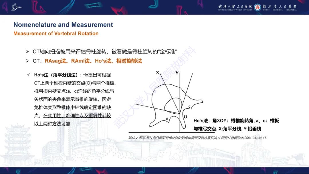 影像PPT - 【PPT】脊柱侧弯影像学评估-23