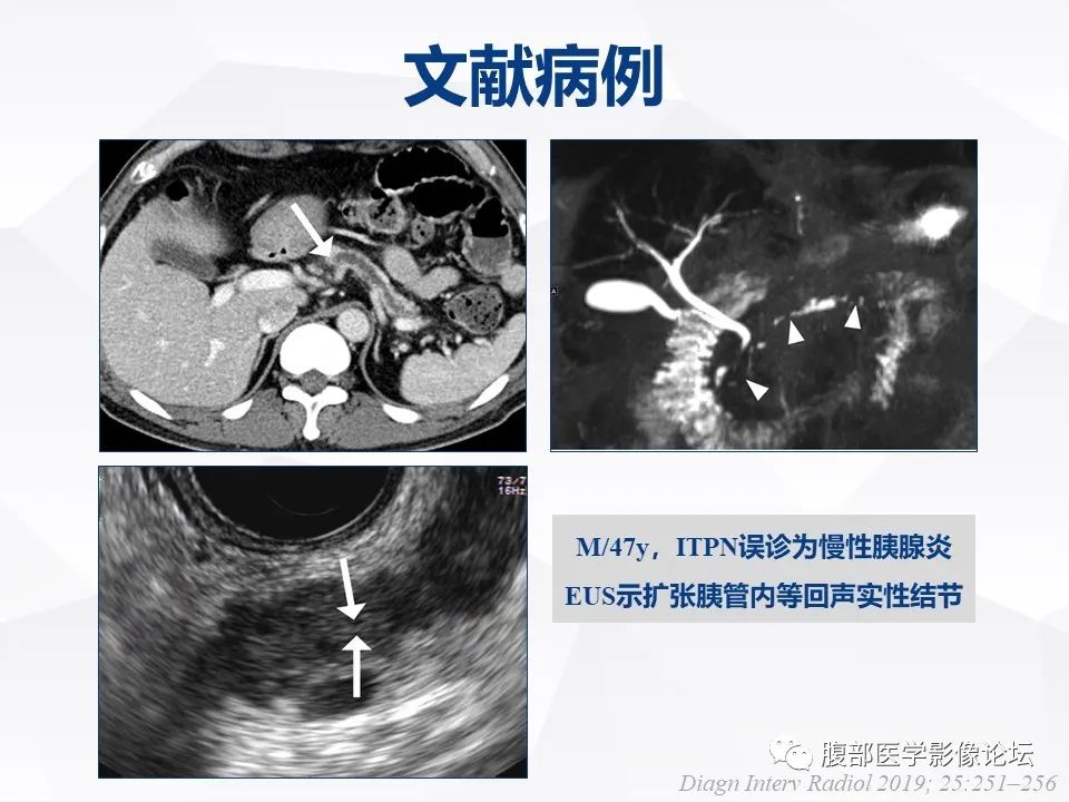 影像PPT - 【病例】胰腺导管内神经内分泌肿瘤1例CT及MR-28