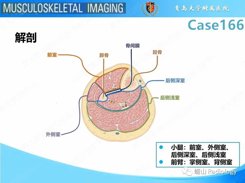影像PPT - 【PPT】骨筋膜室综合征-15