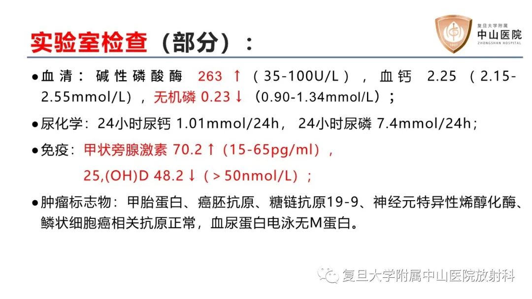 影像PPT - 【病例】肿瘤相关性骨软化症1例X线CT及MR/PET-CT-4