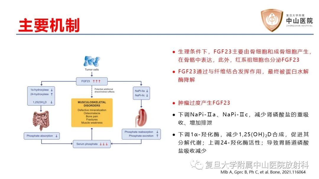 影像PPT - 【病例】肿瘤相关性骨软化症1例X线CT及MR/PET-CT-15
