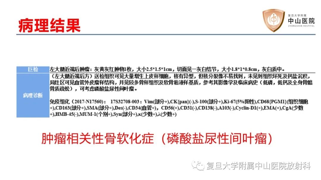影像PPT - 【病例】肿瘤相关性骨软化症1例X线CT及MR/PET-CT-12