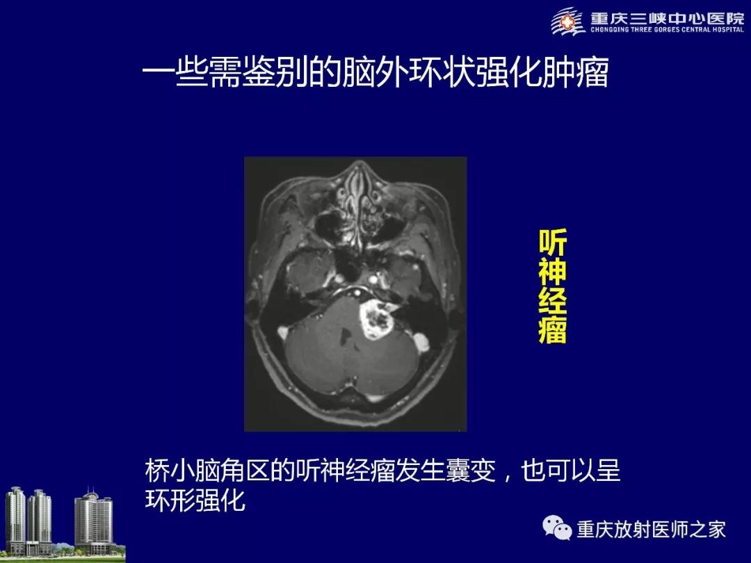 影像PPT - 【PPT】脑内环形强化病变的影像诊断思路-24