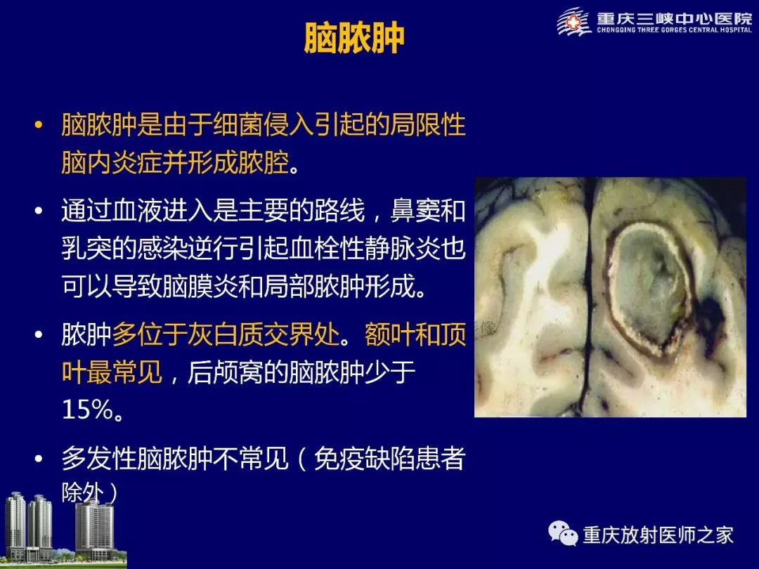 影像PPT - 【PPT】脑内环形强化病变的影像诊断思路-33