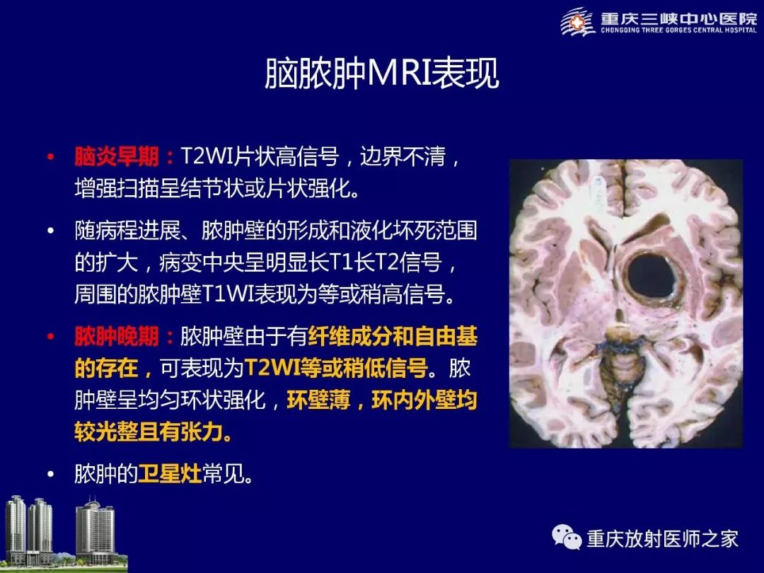 影像PPT - 【PPT】脑内环形强化病变的影像诊断思路-35