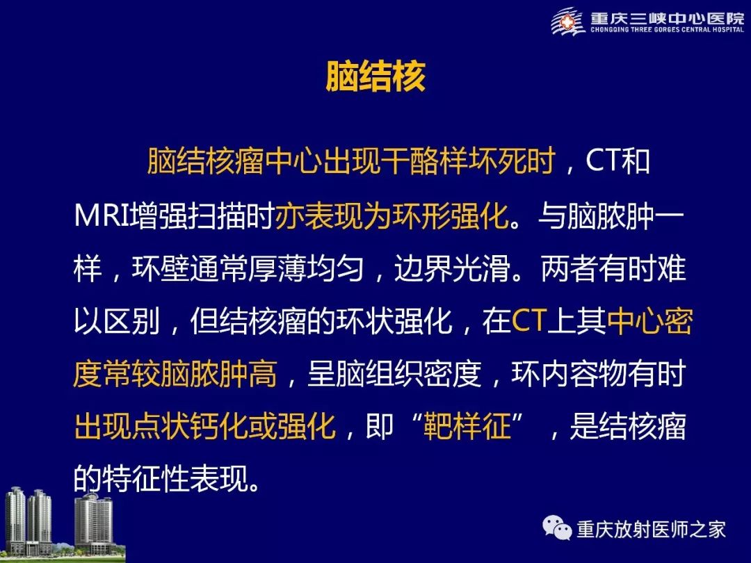 影像PPT - 【PPT】脑内环形强化病变的影像诊断思路-50