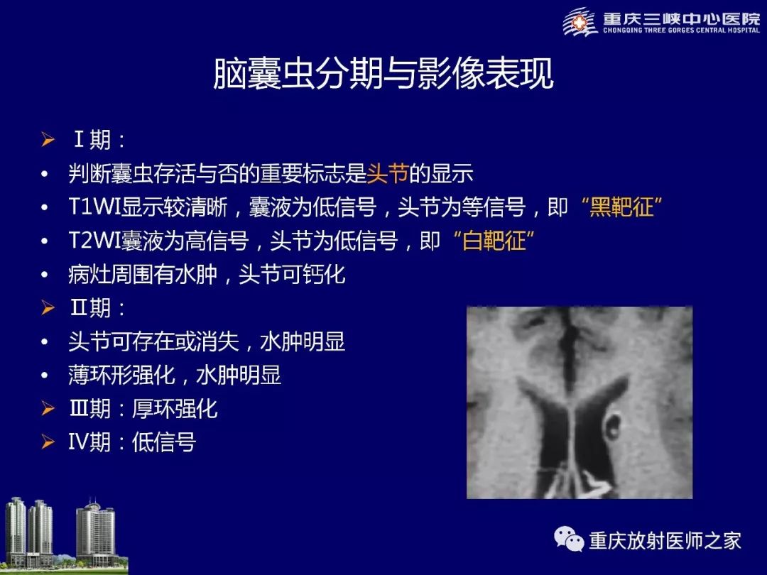 影像PPT - 【PPT】脑内环形强化病变的影像诊断思路-68