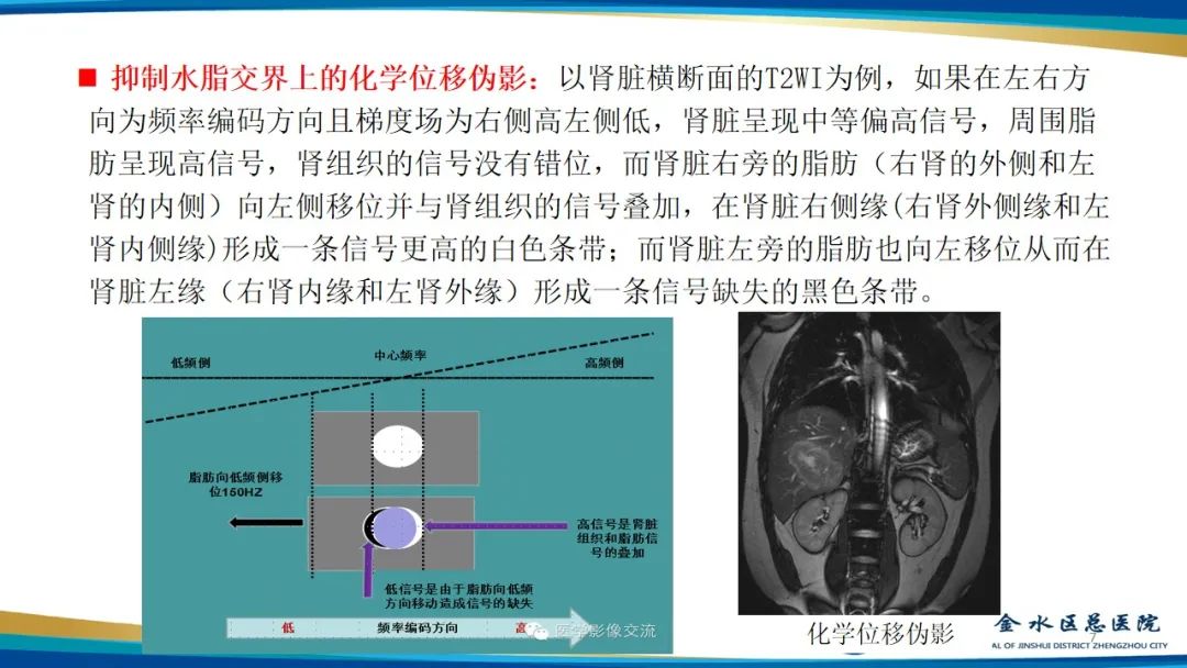 影像PPT - 【PPT】MRI脂肪抑制技术与相关临床应用浅述-7
