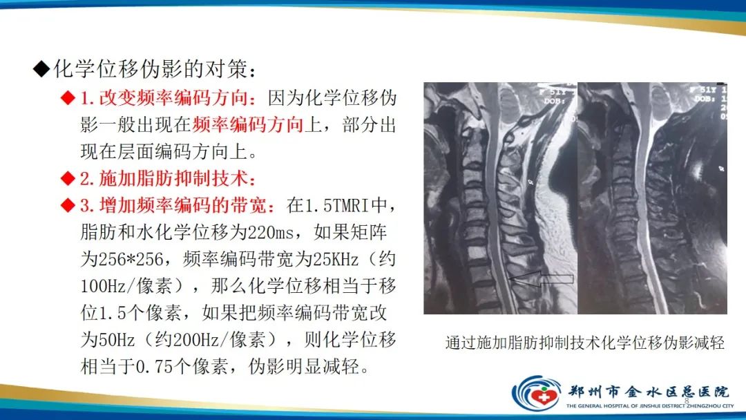 影像PPT - 【PPT】MRI脂肪抑制技术与相关临床应用浅述-8