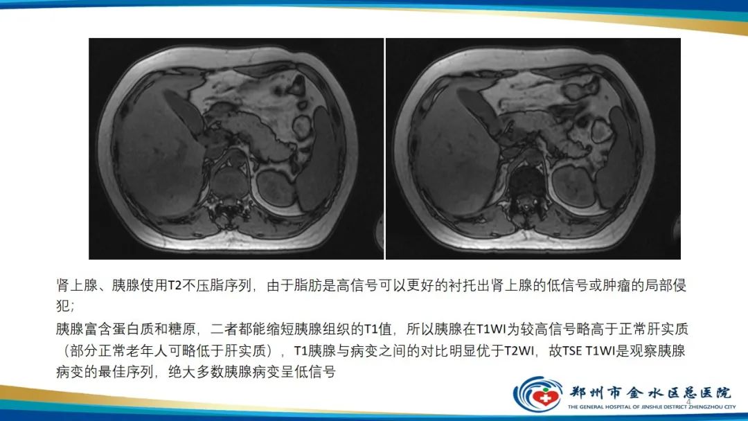 影像PPT - 【PPT】MRI脂肪抑制技术与相关临床应用浅述-4