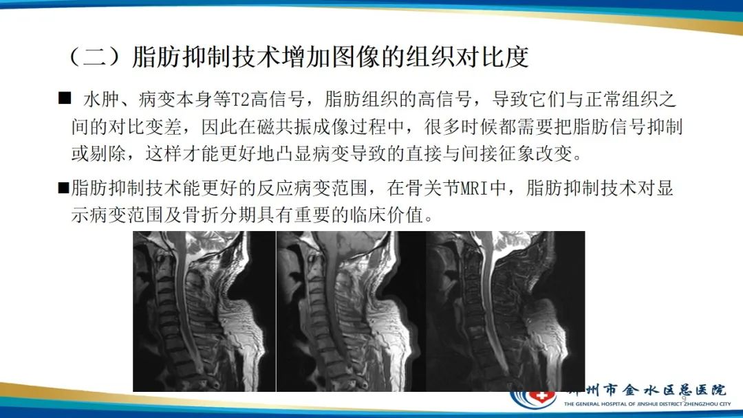 影像PPT - 【PPT】MRI脂肪抑制技术与相关临床应用浅述-9