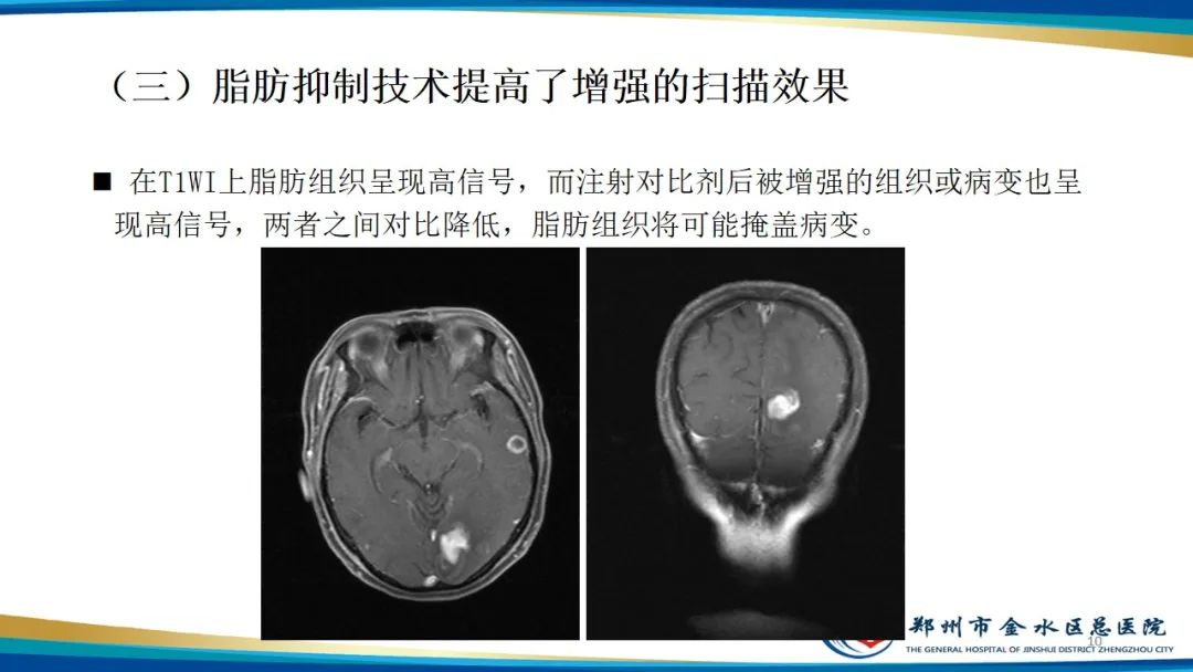 影像PPT - 【PPT】MRI脂肪抑制技术与相关临床应用浅述-10