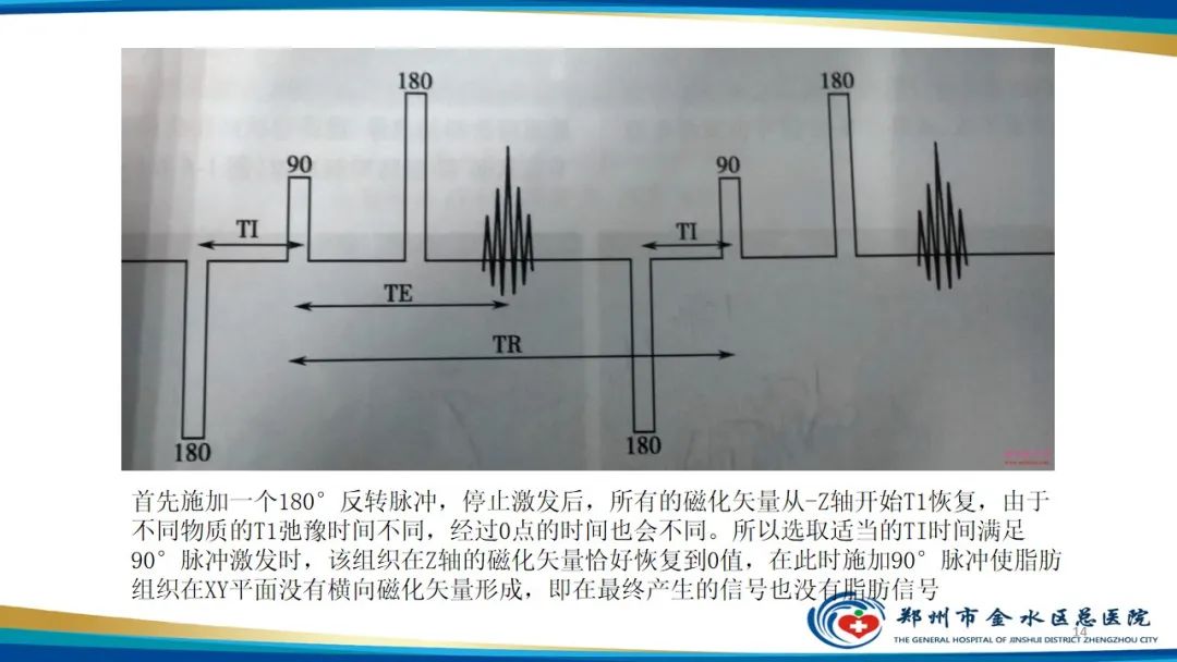 影像PPT - 【PPT】MRI脂肪抑制技术与相关临床应用浅述-14