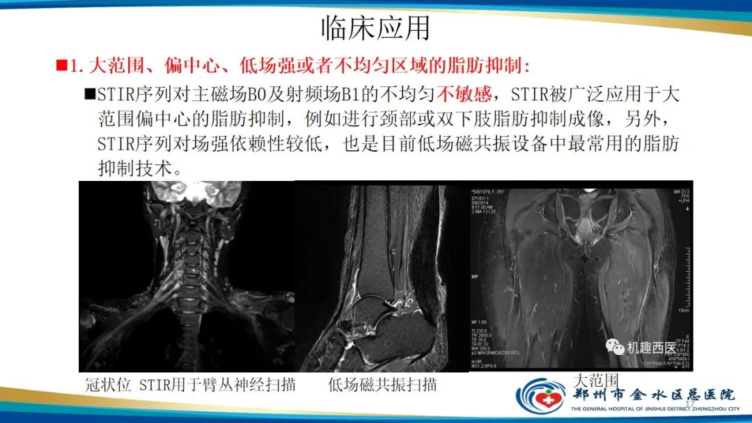 影像PPT - 【PPT】MRI脂肪抑制技术与相关临床应用浅述-17