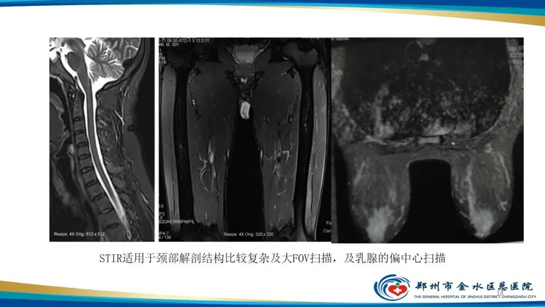 影像PPT - 【PPT】MRI脂肪抑制技术与相关临床应用浅述-18