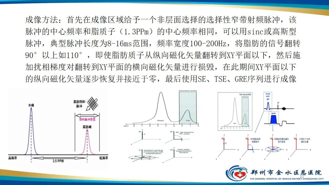 影像PPT - 【PPT】MRI脂肪抑制技术与相关临床应用浅述-21
