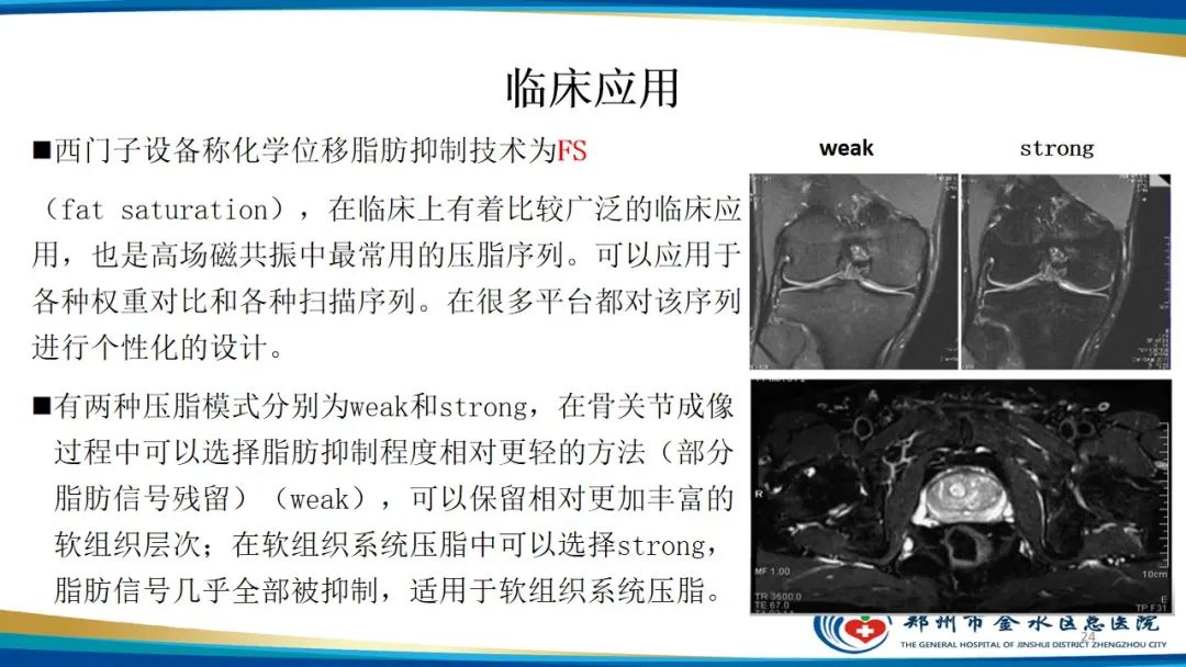 影像PPT - 【PPT】MRI脂肪抑制技术与相关临床应用浅述-24