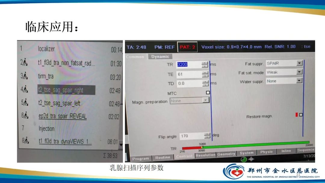 影像PPT - 【PPT】MRI脂肪抑制技术与相关临床应用浅述-31