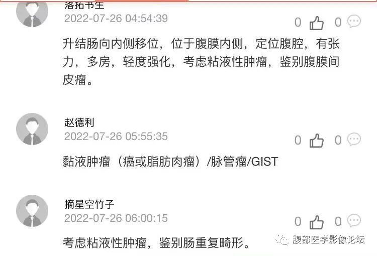 影像PPT - 【病例】良性多囊性腹膜间皮瘤1例CT影像-7