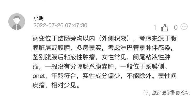 影像PPT - 【病例】良性多囊性腹膜间皮瘤1例CT影像-9