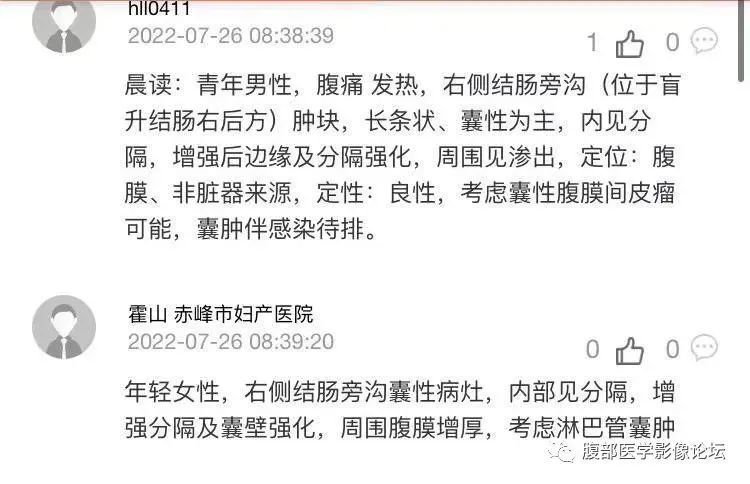 影像PPT - 【病例】良性多囊性腹膜间皮瘤1例CT影像-14