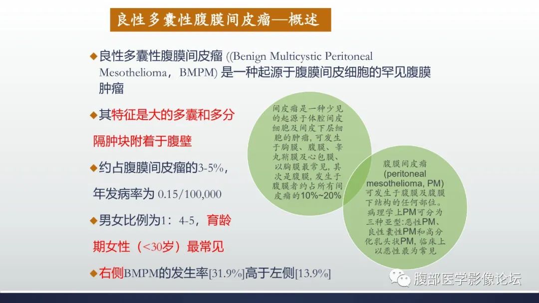 影像PPT - 【病例】良性多囊性腹膜间皮瘤1例CT影像-17
