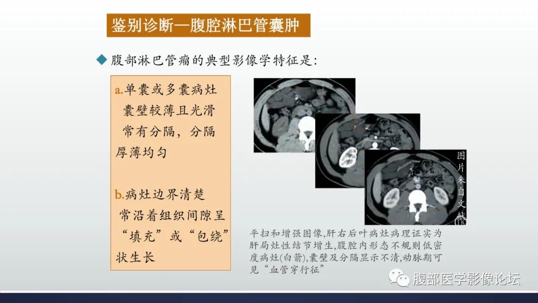 影像PPT - 【病例】良性多囊性腹膜间皮瘤1例CT影像-31