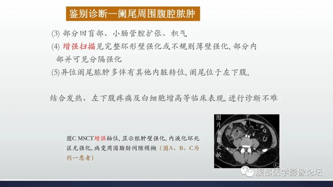 影像PPT - 【病例】良性多囊性腹膜间皮瘤1例CT影像-42