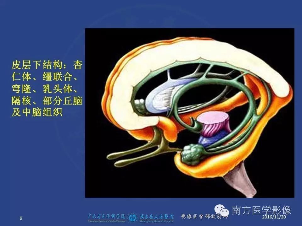 影像PPT - 【PPT】边缘叶脑炎（Limbic encephalitis，LE）-9