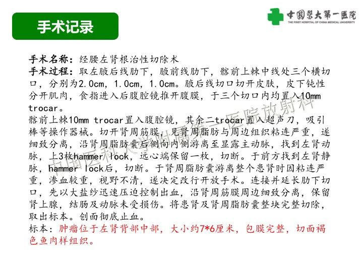 影像PPT - 【病例】肾脏嗜酸细胞腺瘤1例CT影像-7