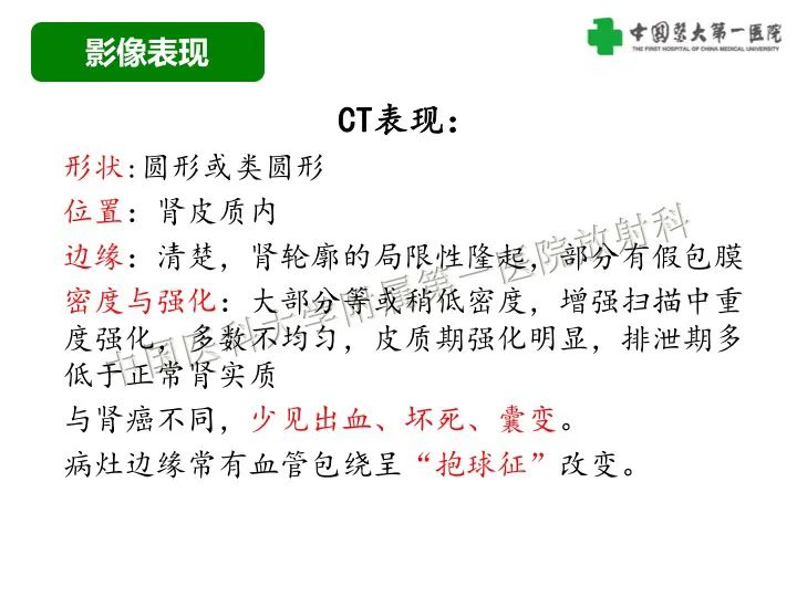 影像PPT - 【病例】肾脏嗜酸细胞腺瘤1例CT影像-16