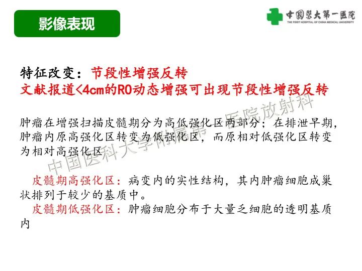 影像PPT - 【病例】肾脏嗜酸细胞腺瘤1例CT影像-18