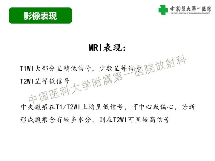 影像PPT - 【病例】肾脏嗜酸细胞腺瘤1例CT影像-19