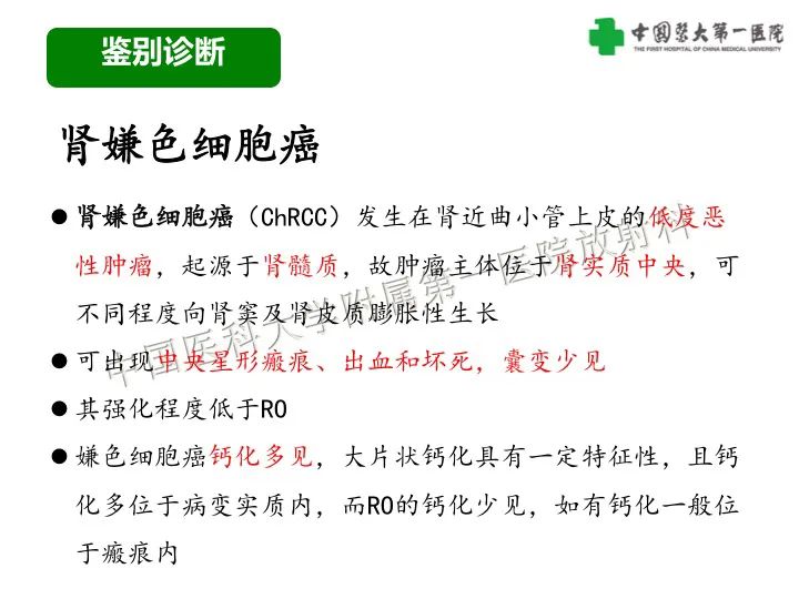 影像PPT - 【病例】肾脏嗜酸细胞腺瘤1例CT影像-29